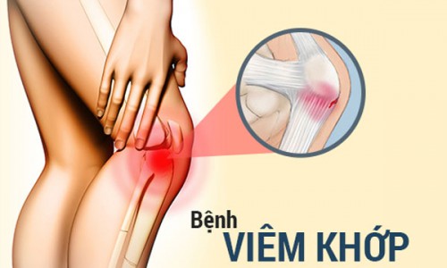 CÁCH PHÒNG NGỪA CÁC BỆNH VỀ KHỚP GỐI